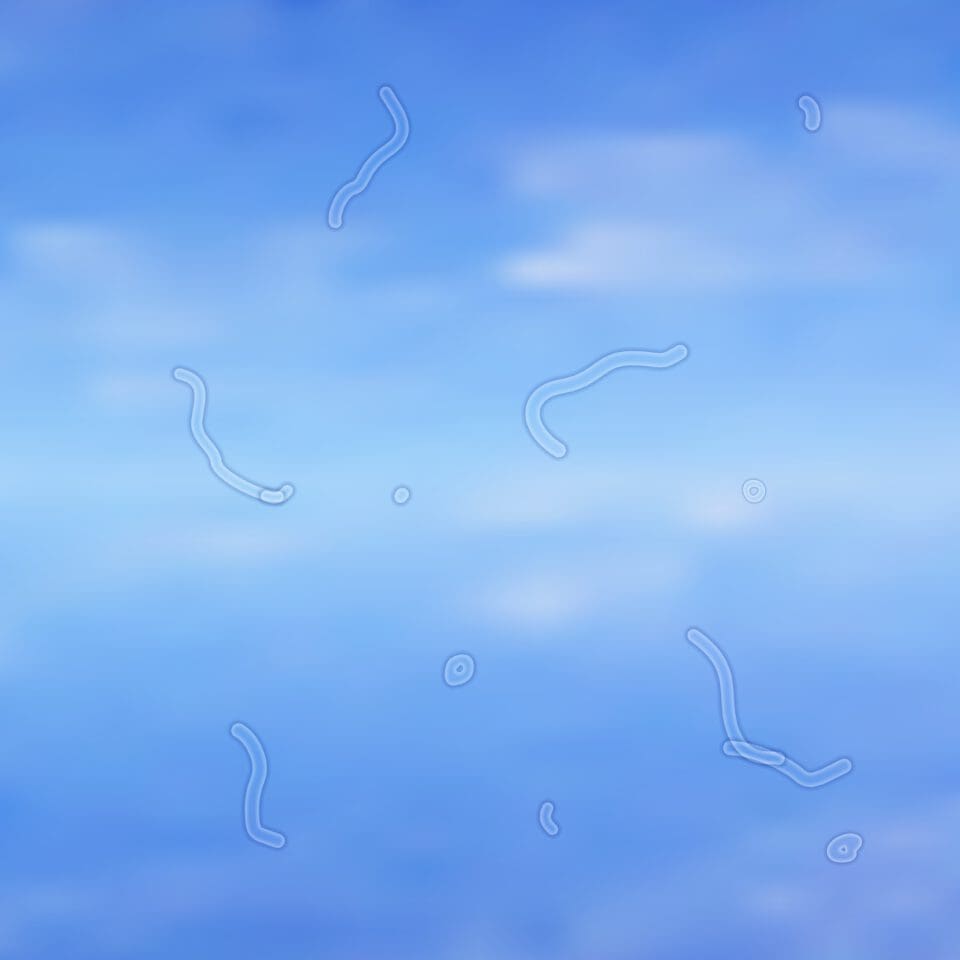 eye floaters